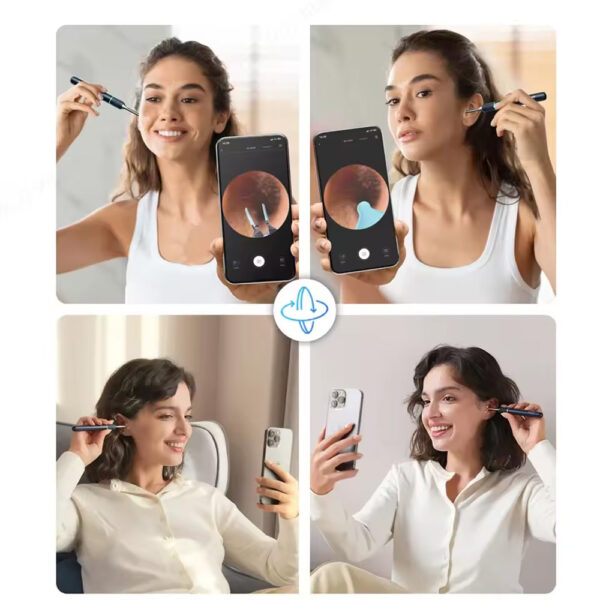 گوش پاک کن هوشمند شیائومی مدل Xiaomi Bebird NOTE5 Pro