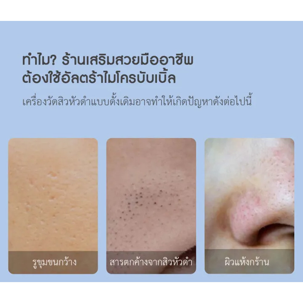 Layer 2 مایع ضدعفونیکننده Xiaomi Doco Ultra Micro Bubble Blackhead Remover