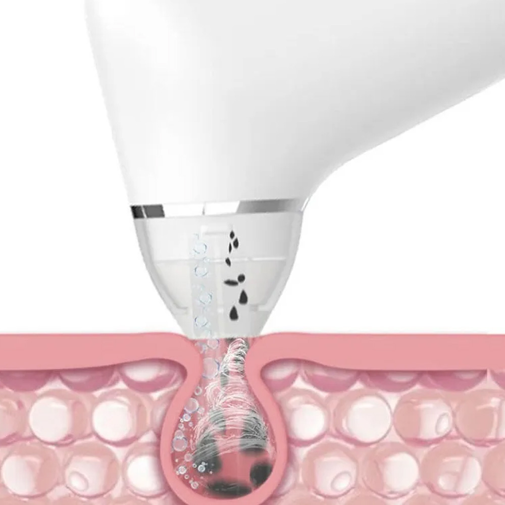 مایع ضدعفونیکننده Xiaomi Doco Ultra Micro Bubble Blackhead Remover