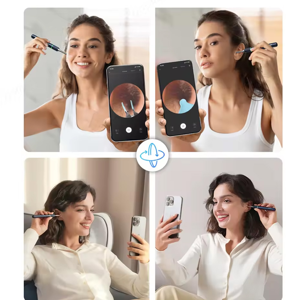 خرید گوش پاککن هوشمند شیائومی Bebird Note 5 | تمیزکننده گوش با دوربین HD و توییزر رباتیک